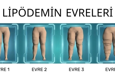"Su i&ccedil;sem yarıyor' diyorsanız Lip&ouml;dem olabilirsiniz!