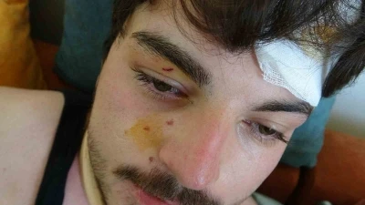 Trafikte darbedilen oyuncu Mehmet Akif Akdeniz yaşadığı dehşeti anlattı