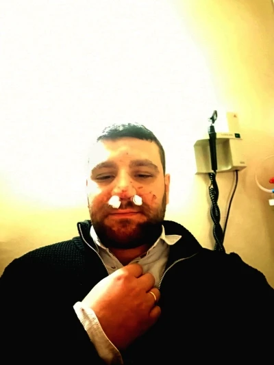 Trafikte yol verme tartışmasında avukatın burnu kırıldı