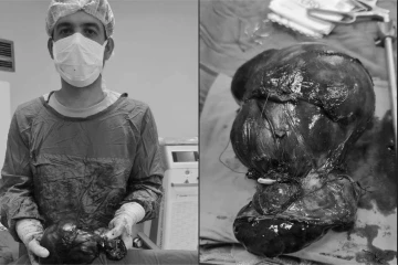 Uşak &Uuml;niversitesi Tıp Fak&uuml;ltesinden başarılı ameliyat
