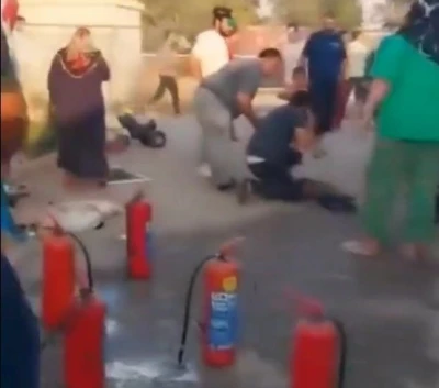 Yangında ağır yaralanan &ccedil;ocuk hayatını kaybetti