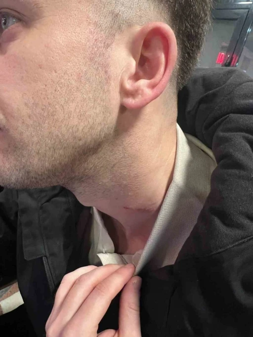 Yeşil saha boks ringine d&ouml;nd&uuml;
